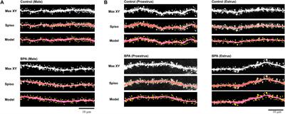 Perinatal Exposure of Bisphenol A Differently Affects Dendritic Spines of Male and Female Grown-Up Adult Hippocampal Neurons